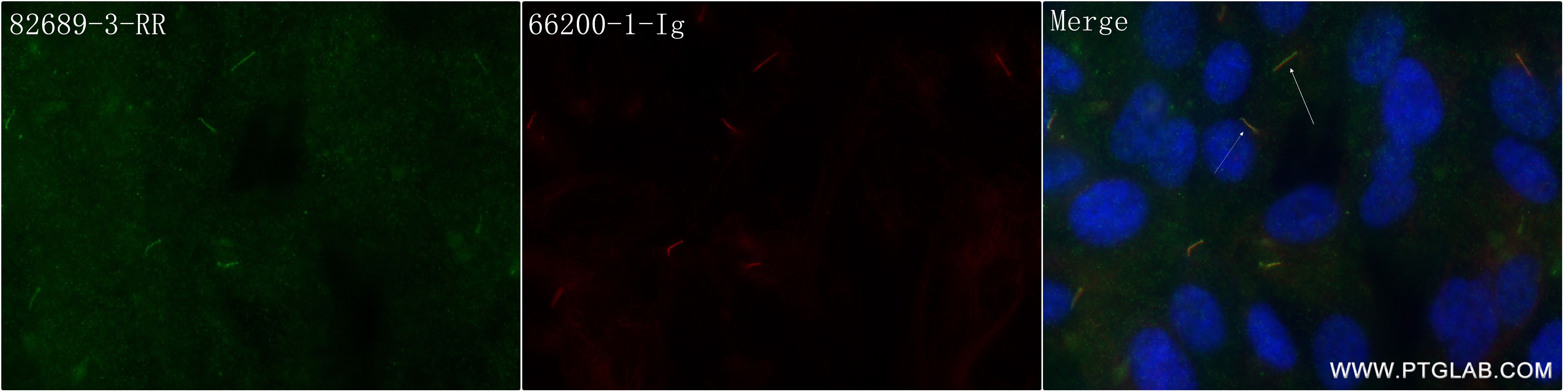 IF Staining of hTERT-RPE1 using 82689-3-RR