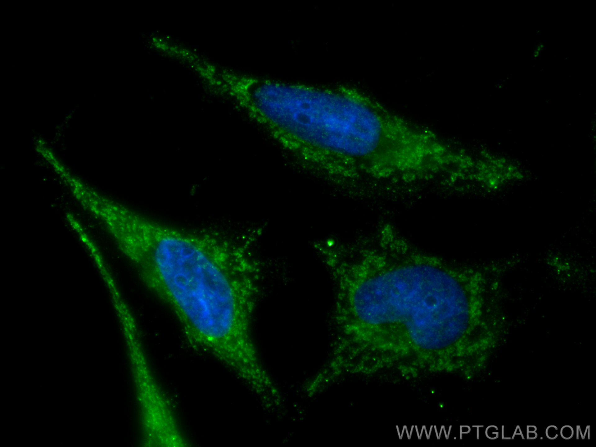 IF Staining of HeLa using 29949-1-AP