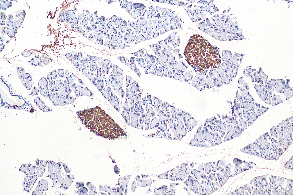 IHC staining of mouse pancreas using 15848-1-AP