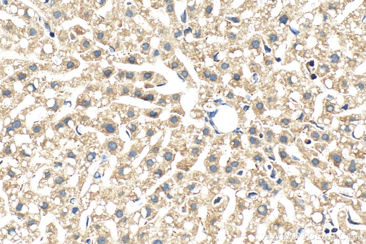 IHC staining of mouse liver using 55282-1-AP