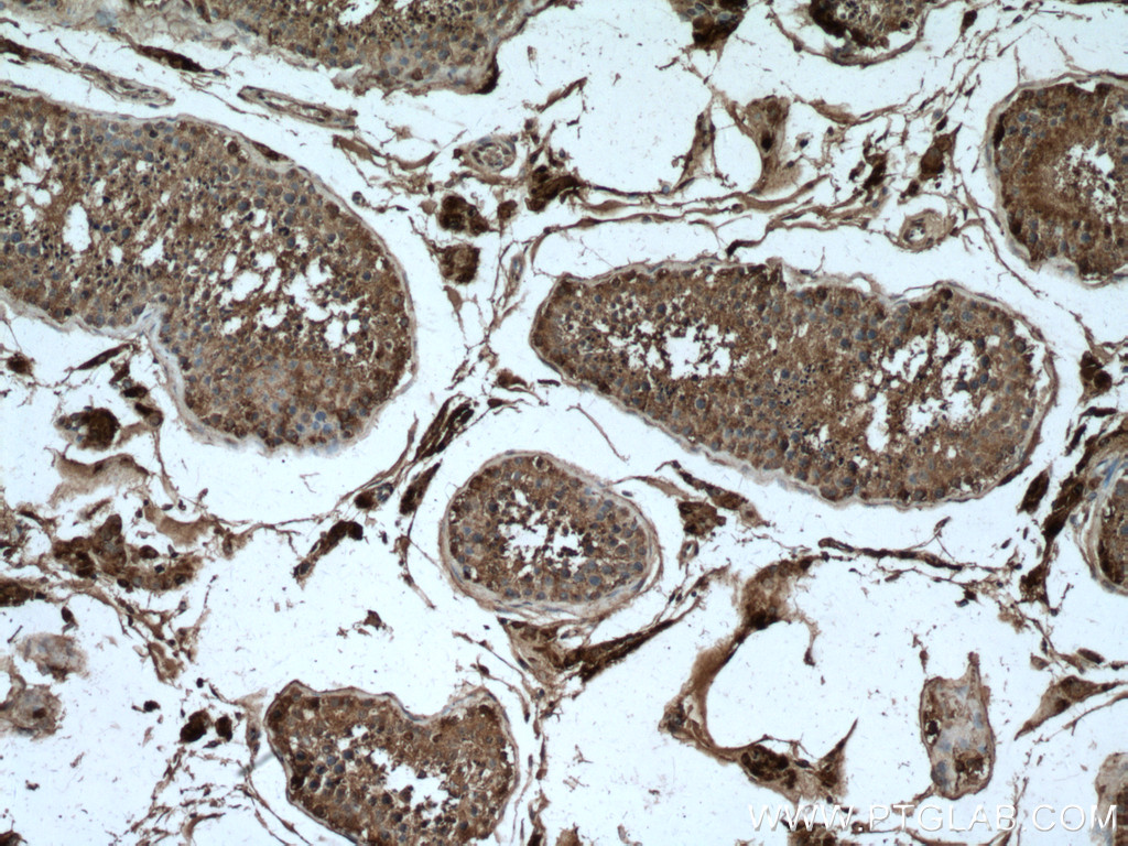 IHC staining of human testis using 17997-1-AP