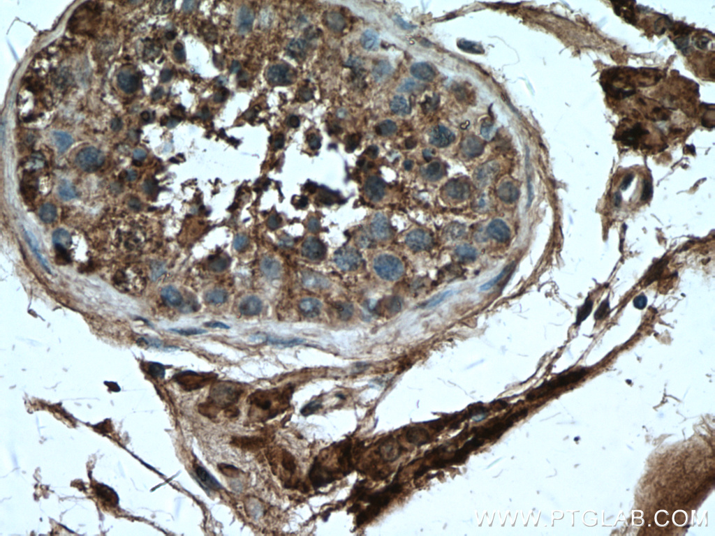 IHC staining of human testis using 17997-1-AP