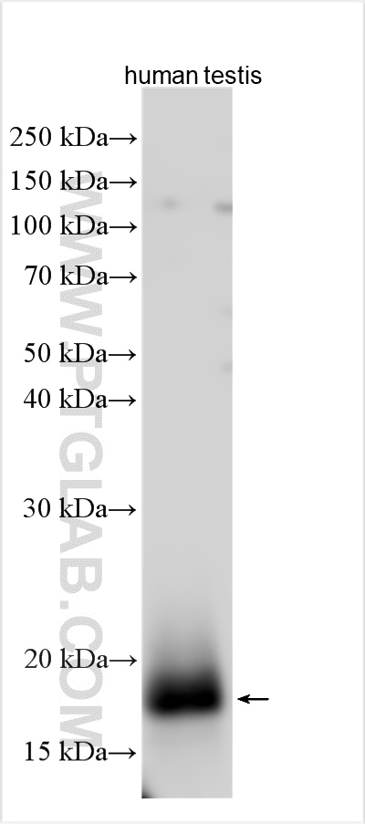 WB analysis using 17997-1-AP