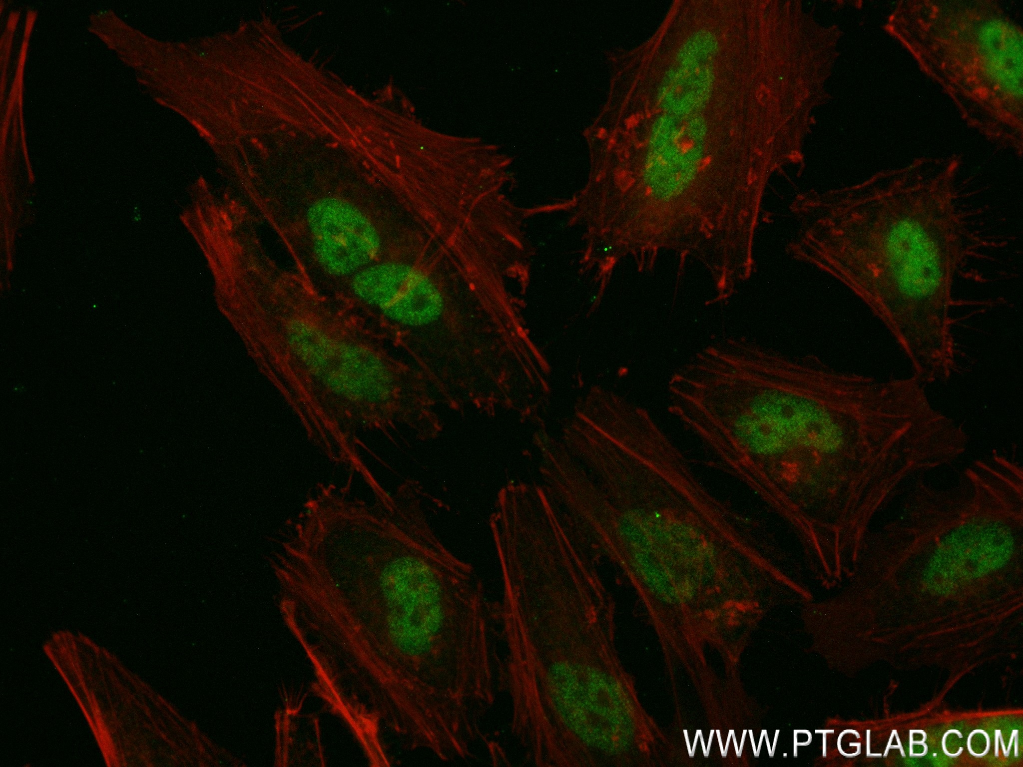 IF Staining of HeLa using 83590-6-RR