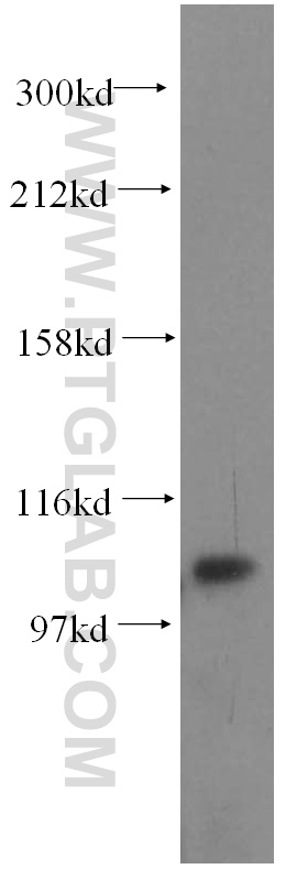 WB analysis of HEK-293 using 17054-1-AP