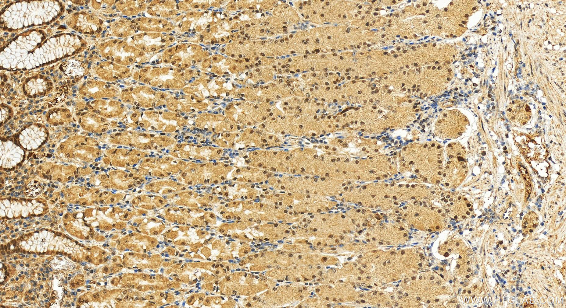 IHC staining of human stomach using 11657-1-AP