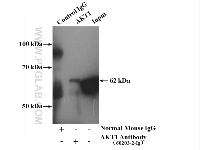 IP result of anti-AKT (IP:60203-2-Ig, 5ug; Detection:60203-2-Ig 1:1000) with mouse brain tissue lysate 4000ug.