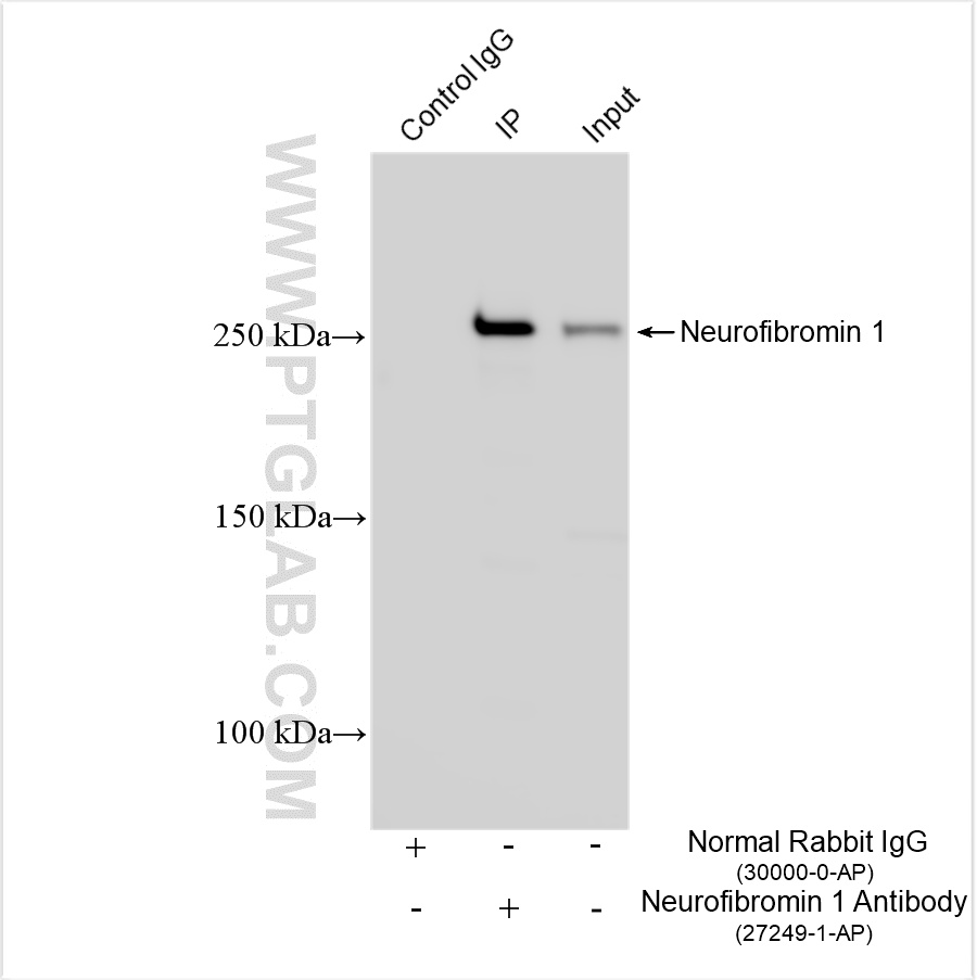 IP result of anti-Neurofibromin 1 (IP: 27249-1-AP, 4 ug; Detection: 27249-1-AP 1:1000) with HEK-293 cells lysate 1800 ug. IP result of anti-Neurofibromin 1 (IP: 27249-1-AP, 4 ug; Detection: 27249-1-AP 1:1000) with HEK-293 cells lysate 1800 ug.