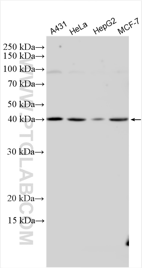 WB analysis using 30161-1-AP (same clone as 30161-1-PBS)