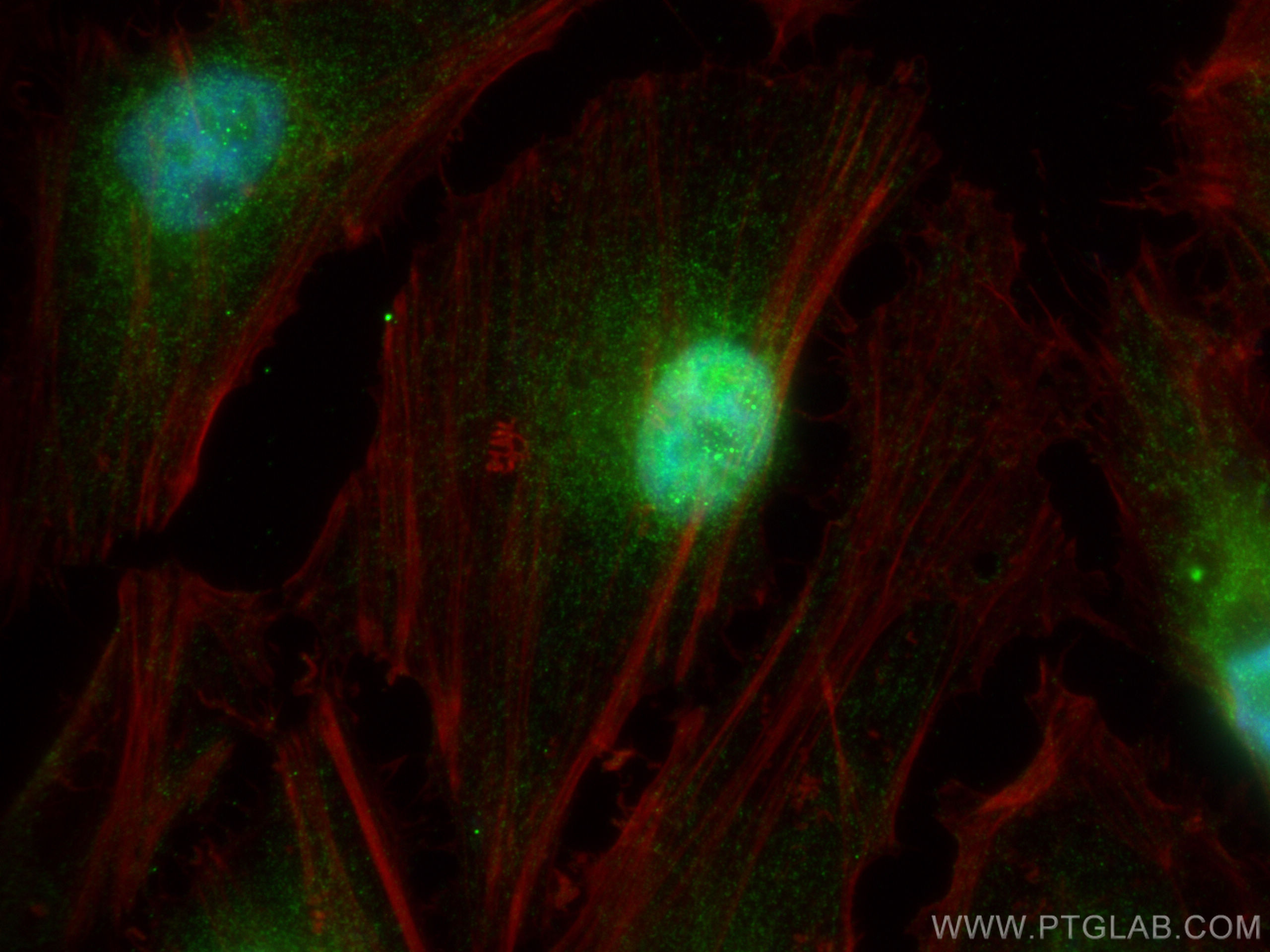 IF Staining of HeLa using 11696-2-AP