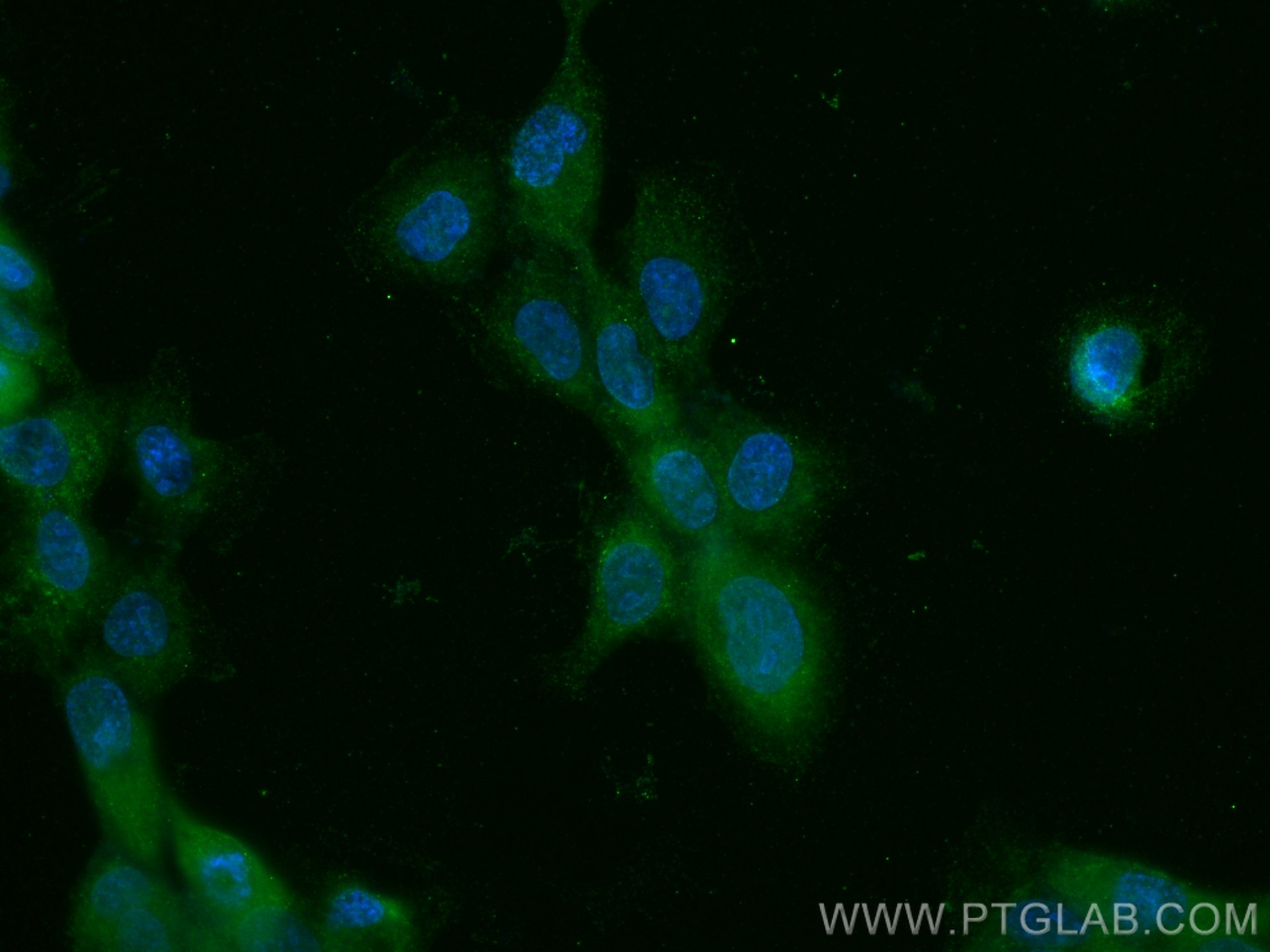 IF Staining of A431 using 67962-1-Ig