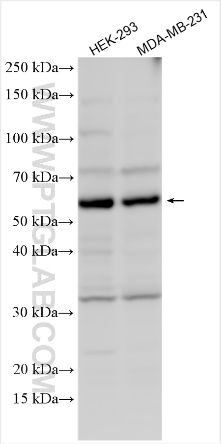 WB analysis using 21533-1-AP