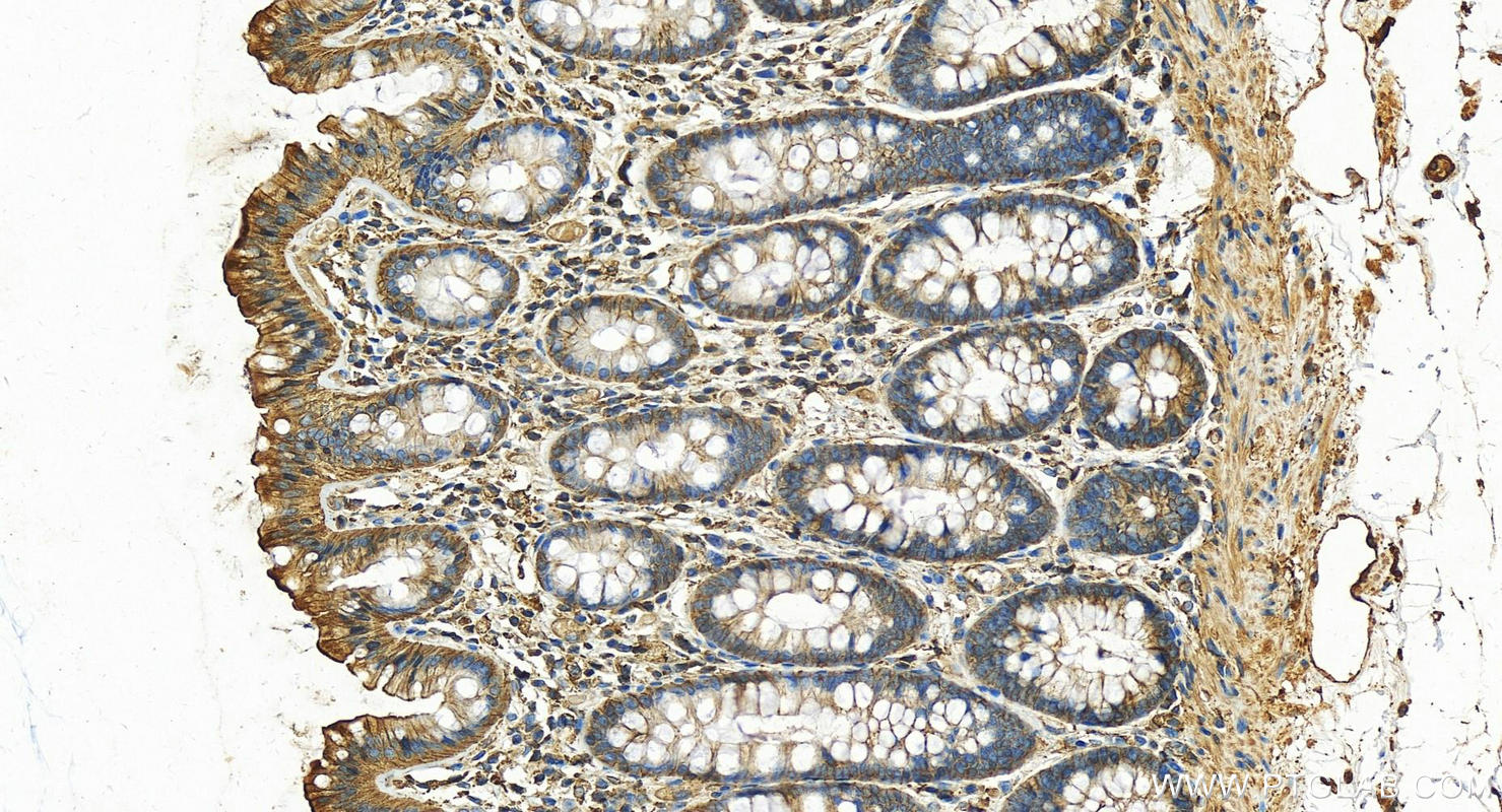 IHC staining of human normal colon using 22167-1-AP