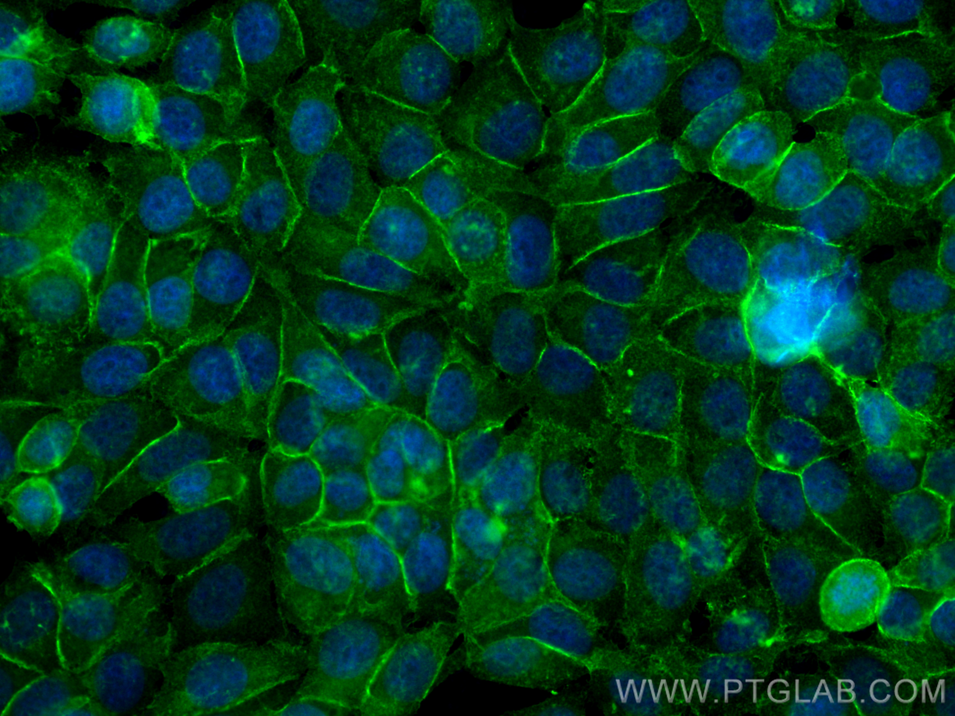 IF Staining of MCF-7 using 22167-1-AP