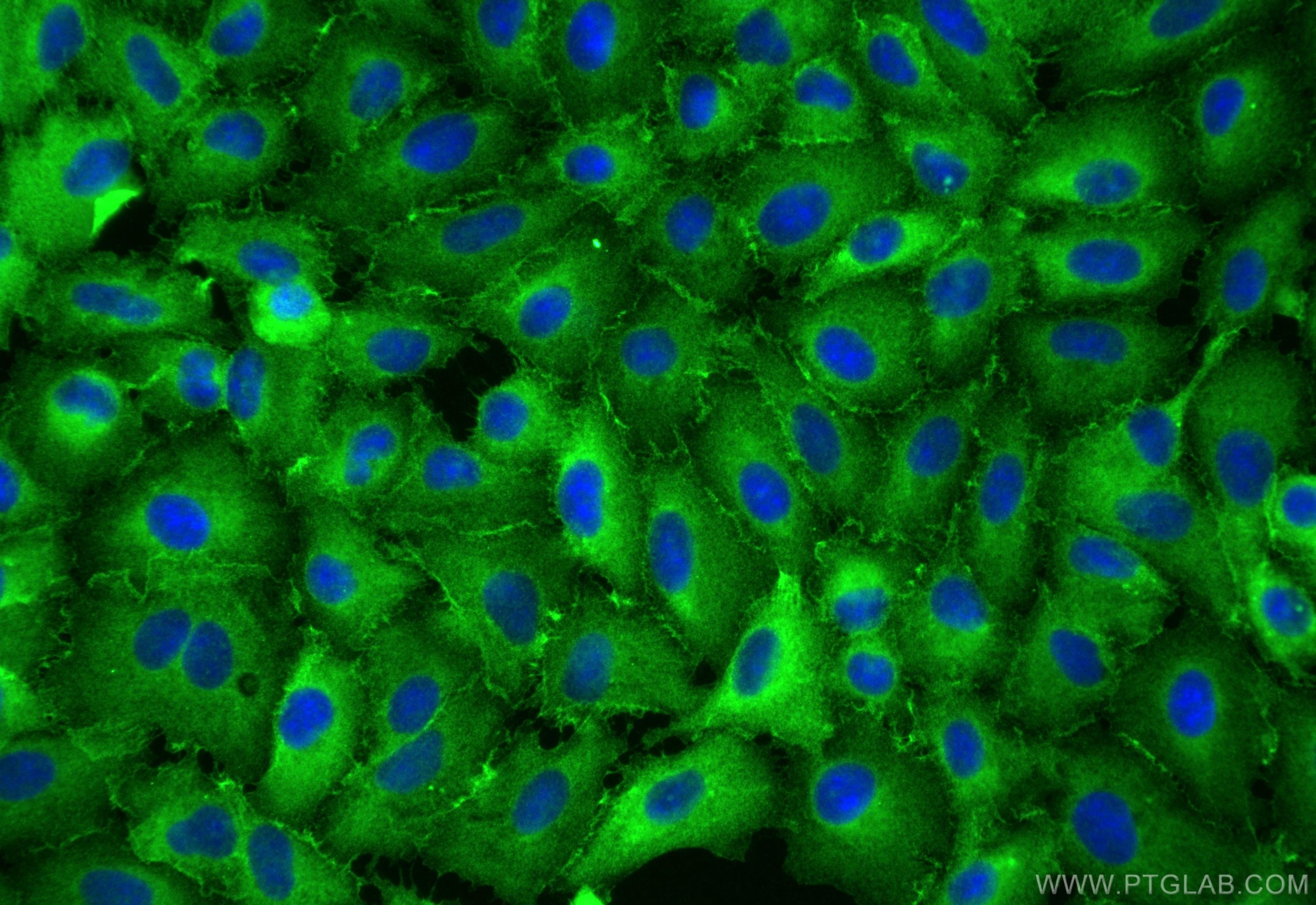 IF Staining of A549 using 22167-1-AP