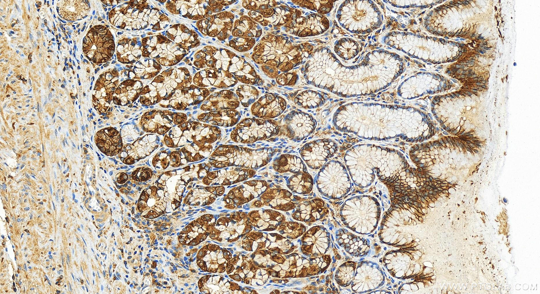 IHC staining of human stomach using 30692-1-AP