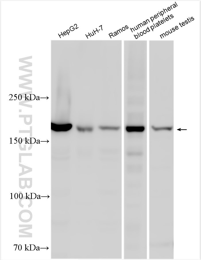 WB analysis using 30692-1-AP