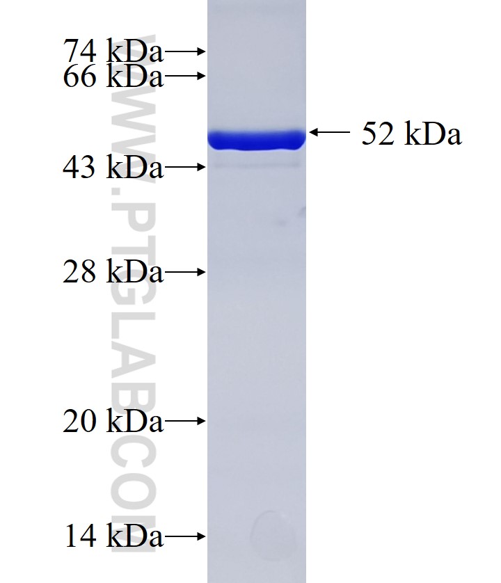 IQGAP2 fusion protein Ag33518 SDS-PAGE