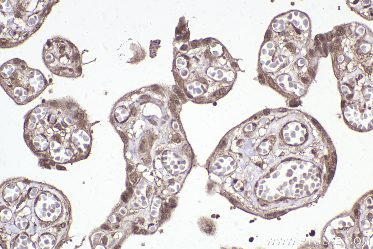 IHC staining of human placenta using 10478-2-AP