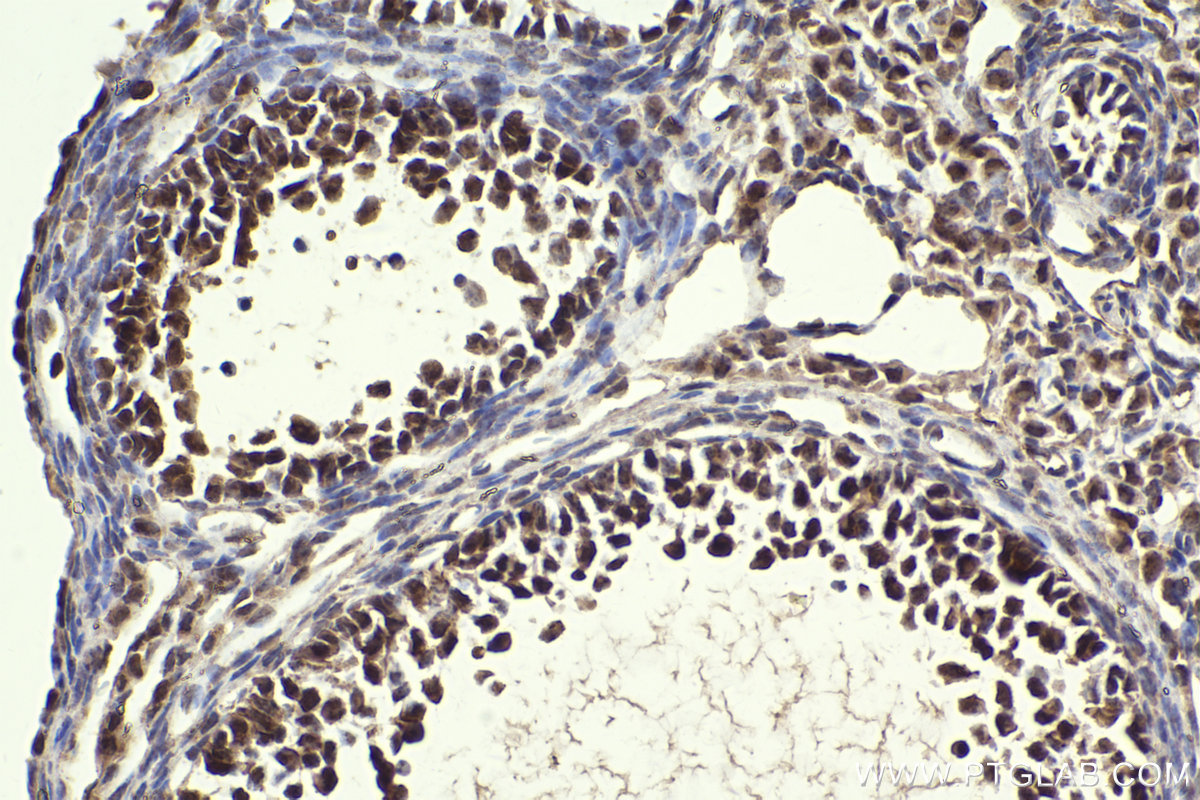 IHC staining of mouse ovary using 10478-2-AP