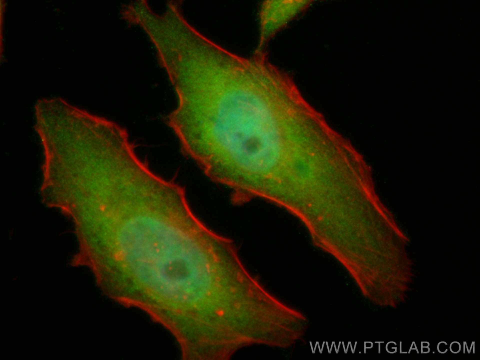 IF Staining of HeLa using CL488-10478