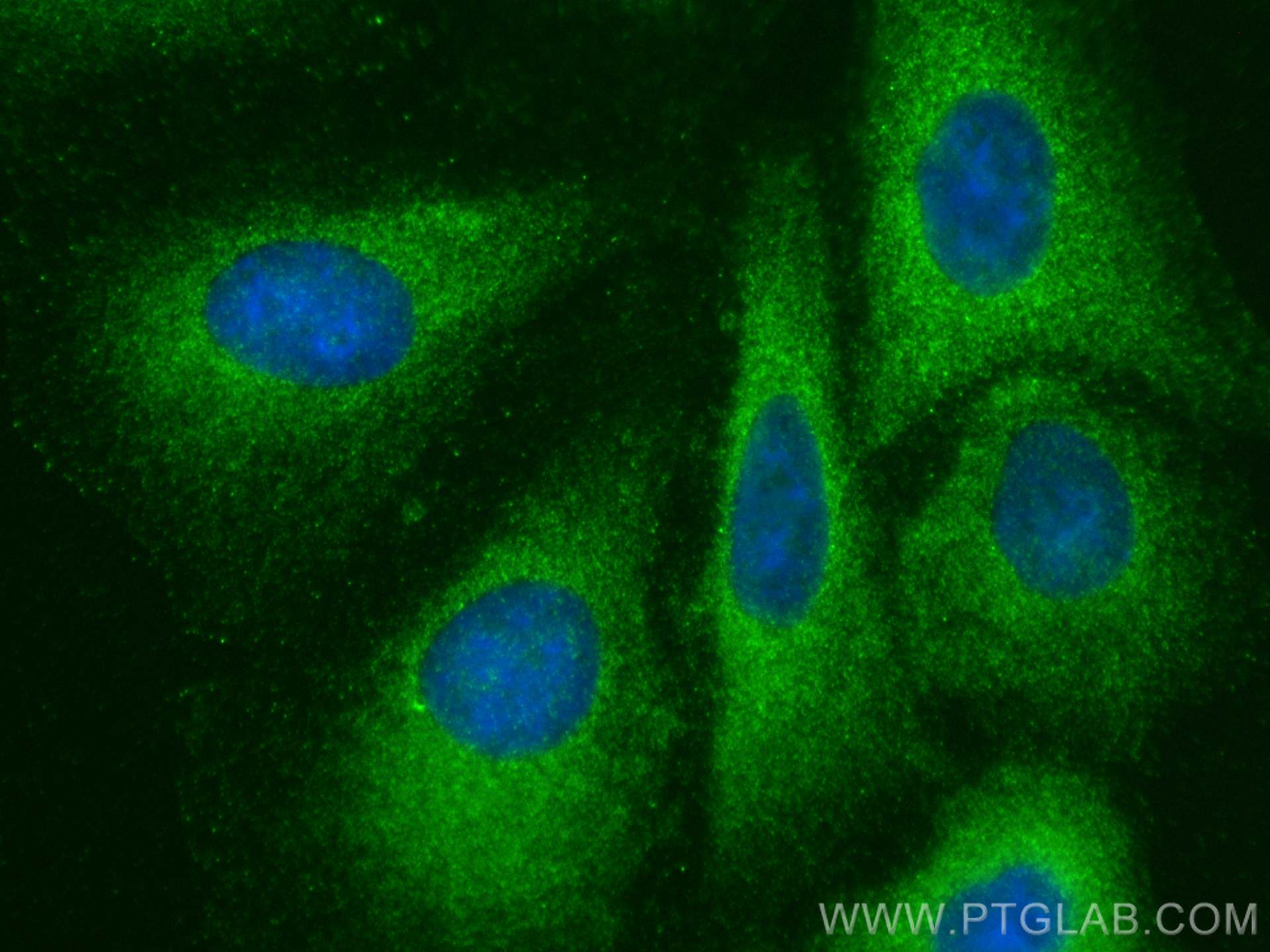 IF Staining of A549 using 29976-1-AP