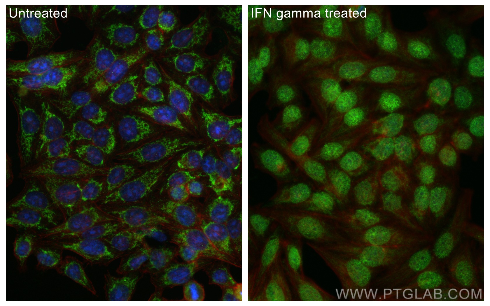 IF Staining of HepG2 using 11335-1-AP