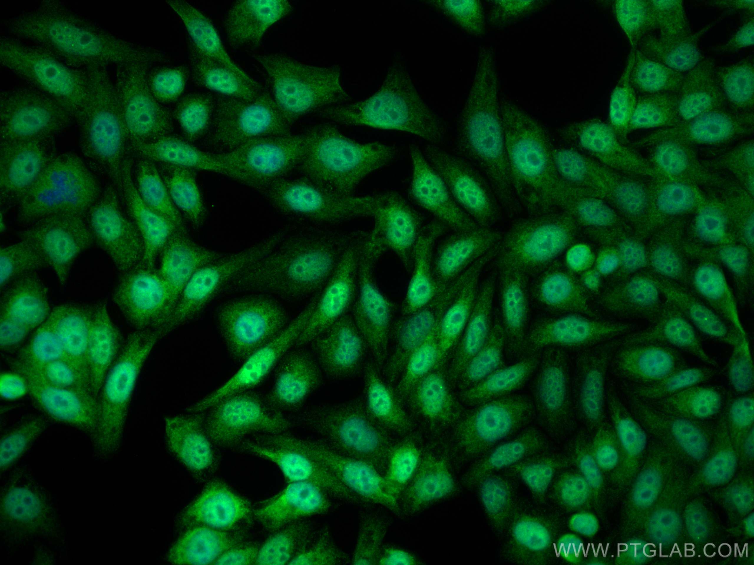 IF Staining of HepG2 using 18847-1-AP