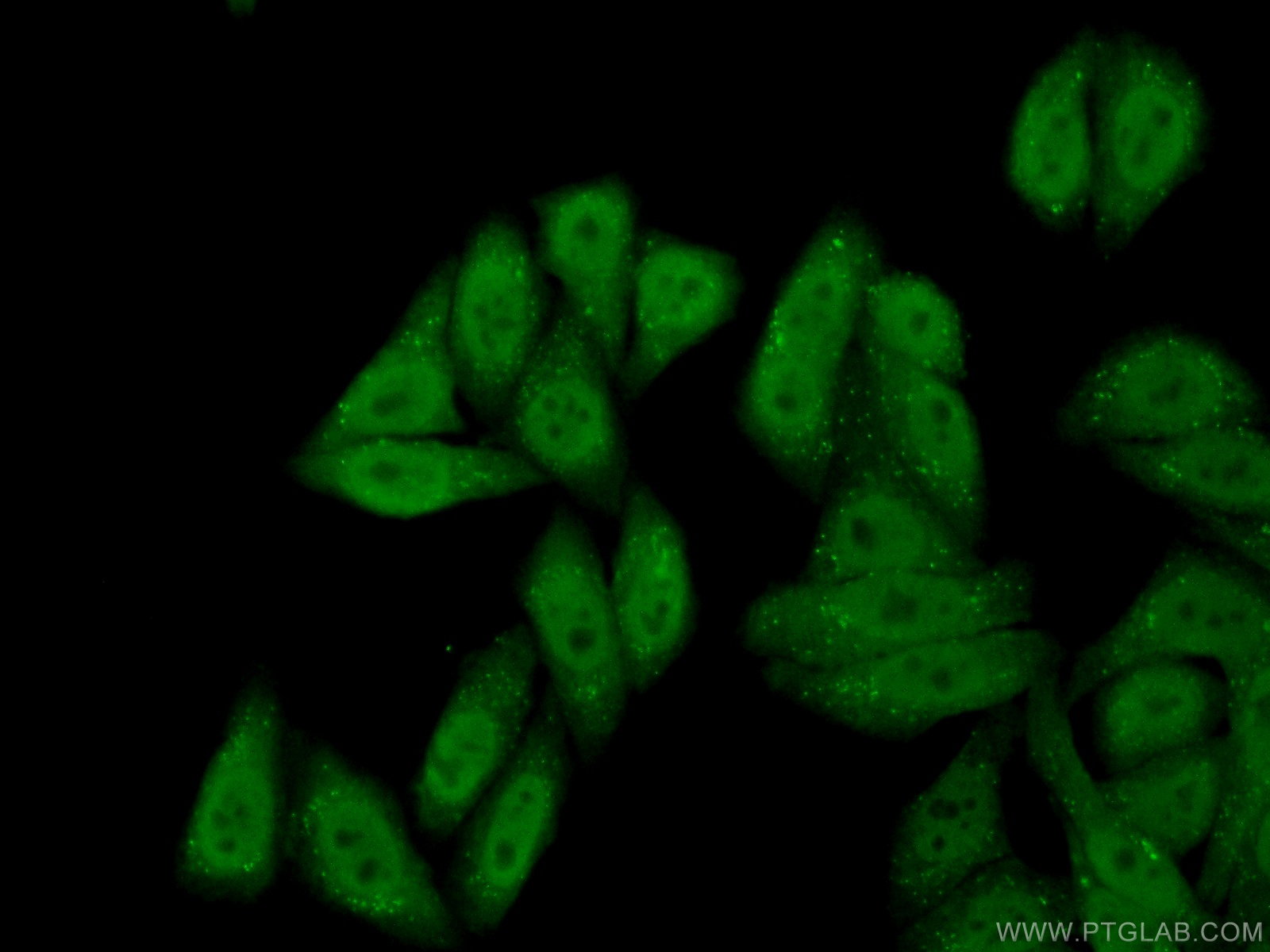 IF Staining of HepG2 using 18847-1-AP