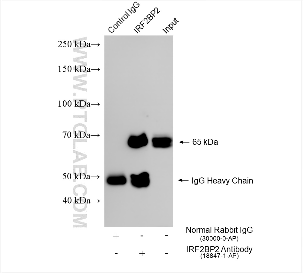 IP experiment of K-562 using 18847-1-AP