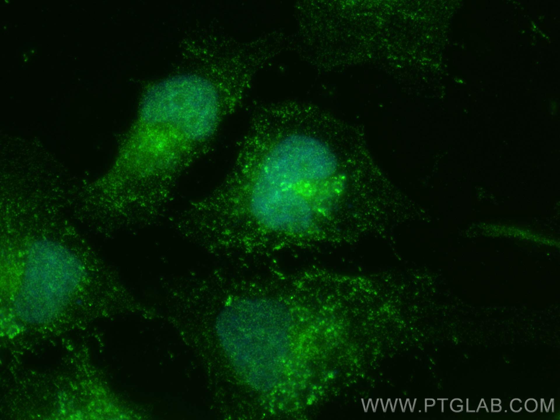 IF Staining of HeLa using 11312-1-AP