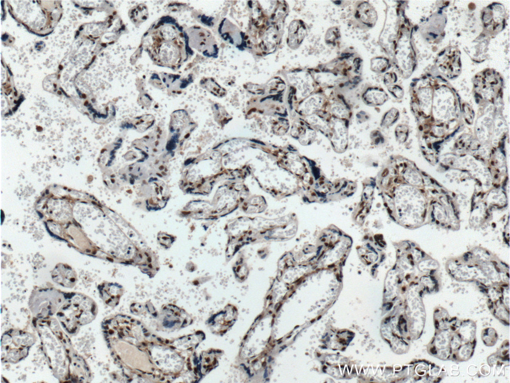 IHC staining of human placenta using 60088-1-Ig