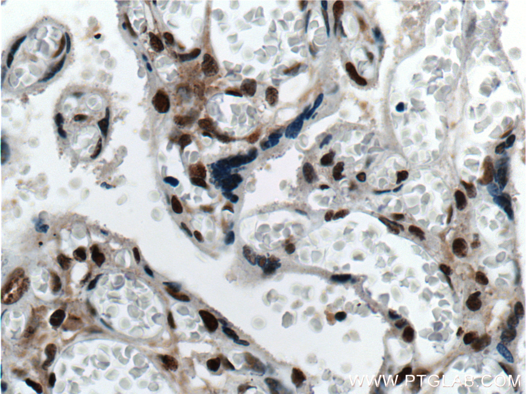 IHC staining of human placenta using 60088-1-Ig