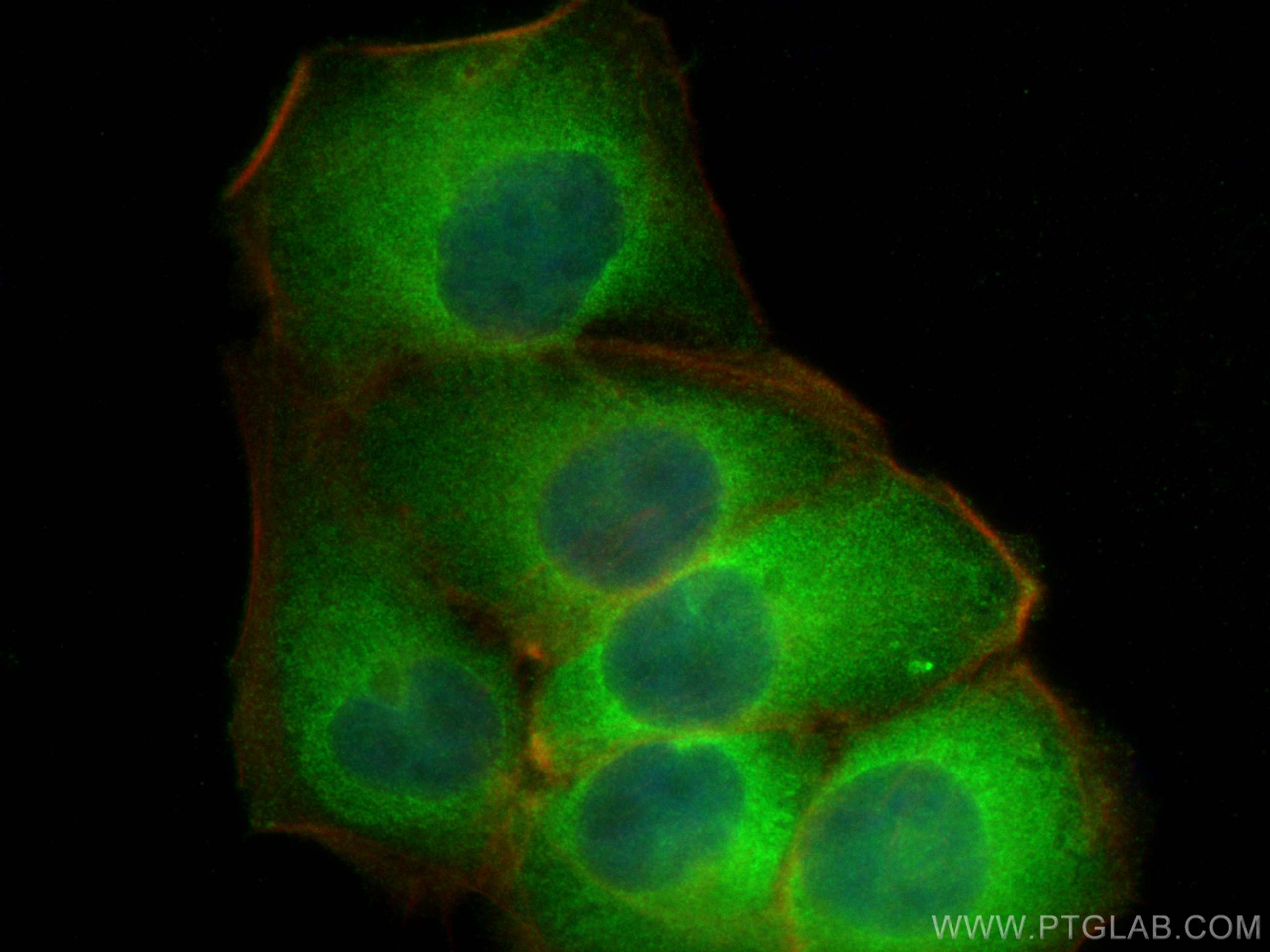 IF Staining of HaCaT using 12928-1-AP