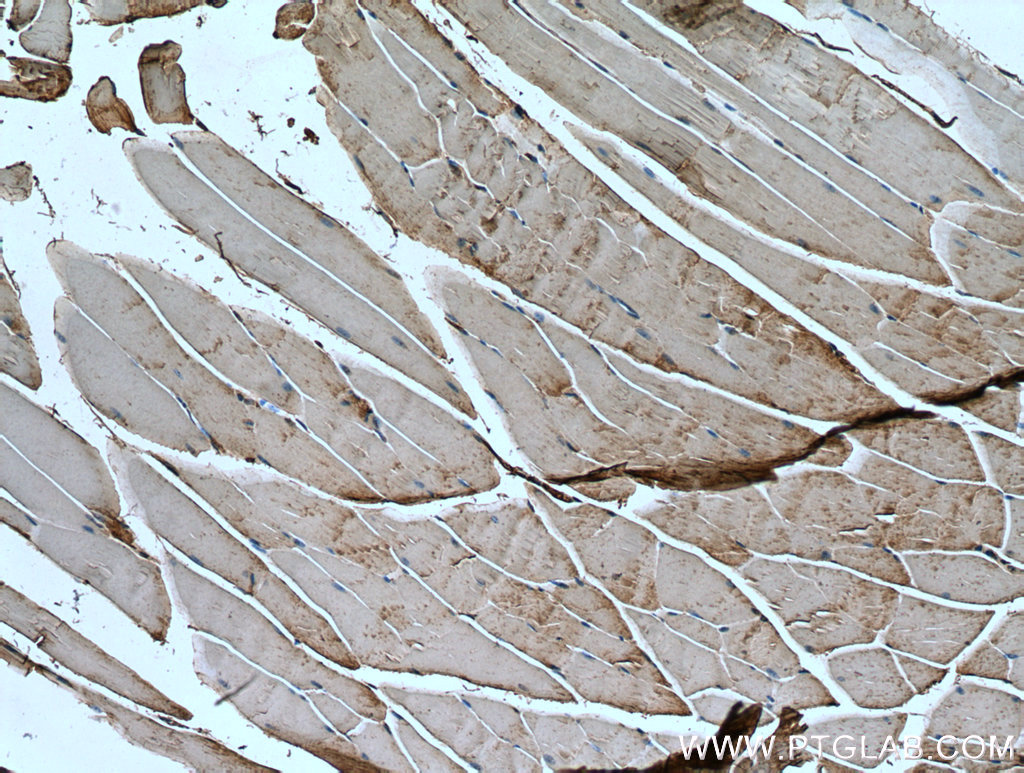 IHC staining of mouse skeletal muscle using 20702-1-AP