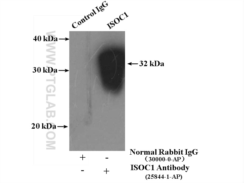 IP experiment of mouse liver using 25844-1-AP