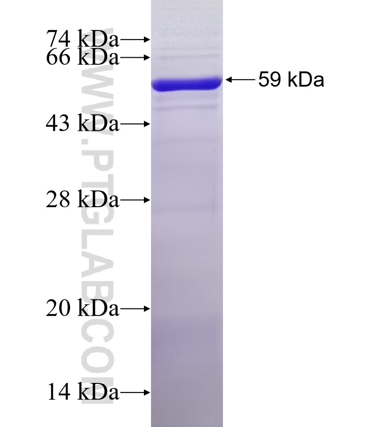 ITGA2 fusion protein Ag32771 SDS-PAGE