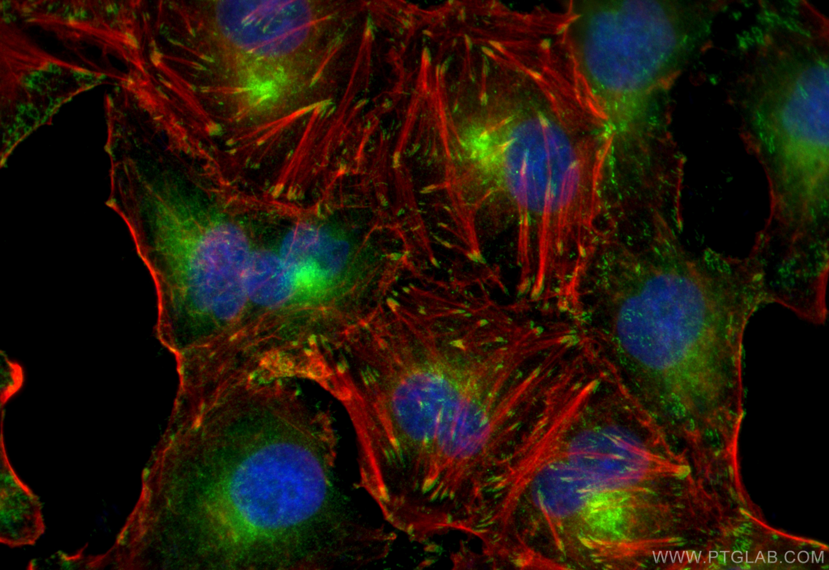 IF Staining of A549 using 27096-1-AP