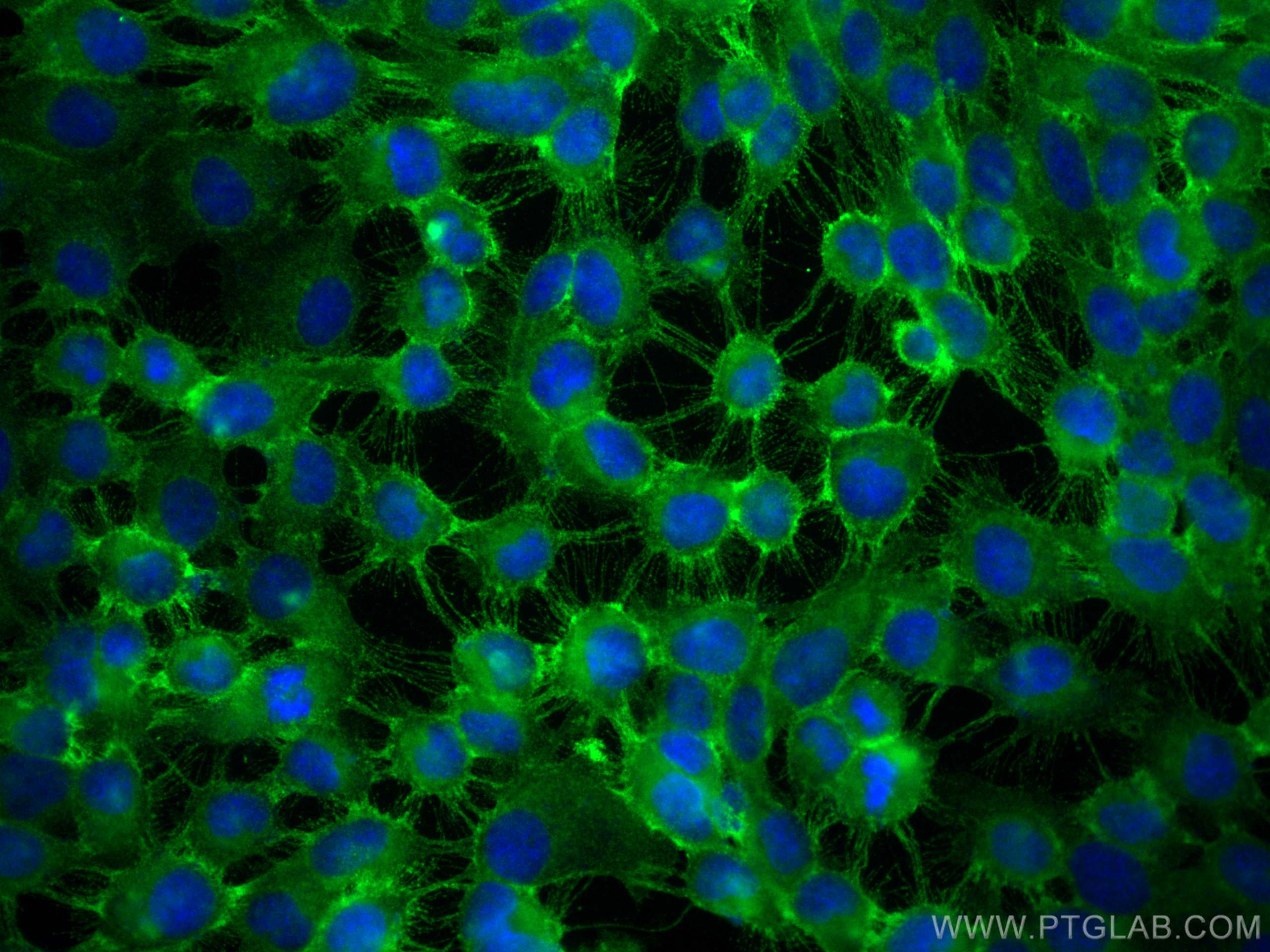 IF Staining of A431 using 12594-1-AP