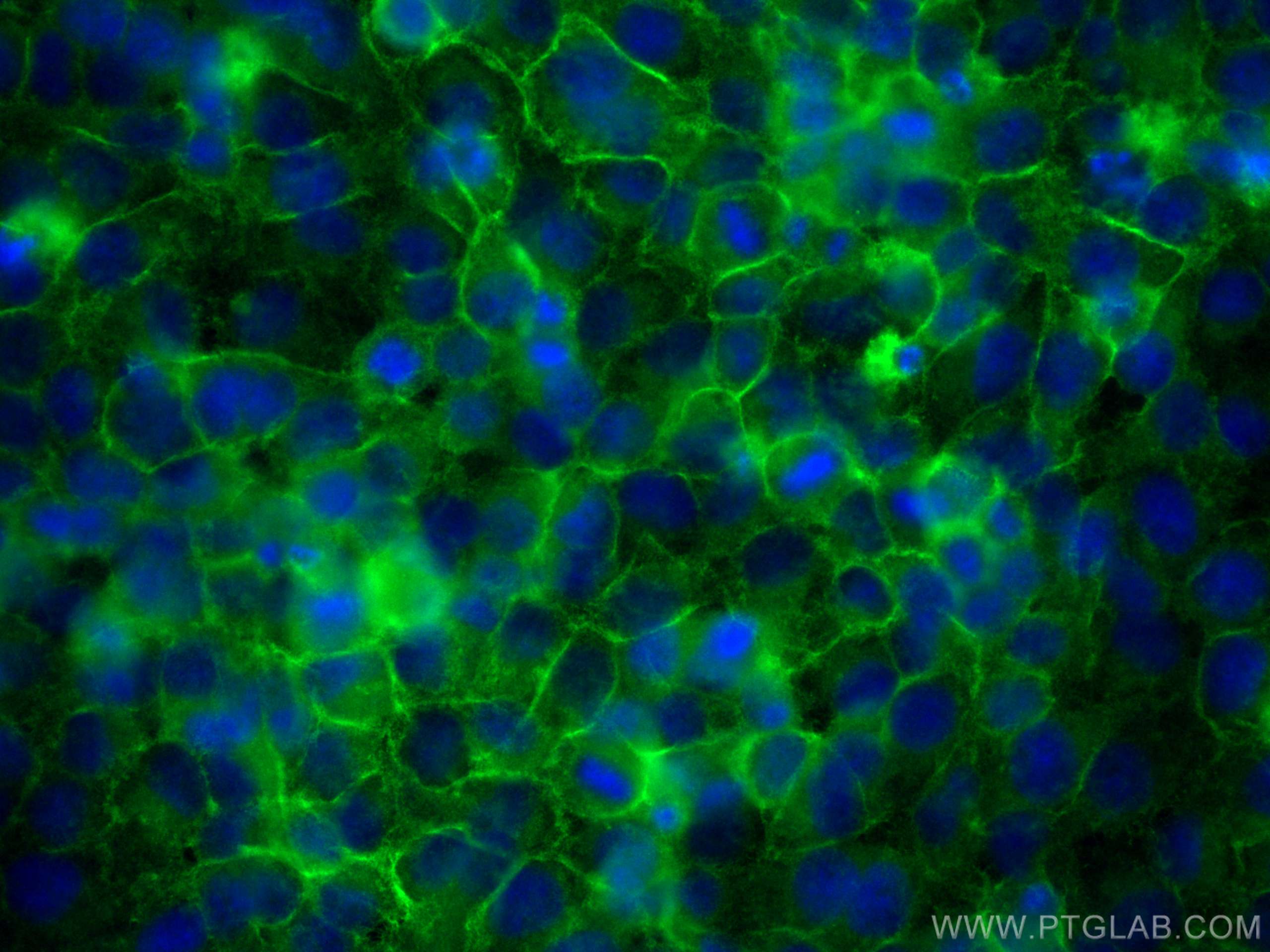 IF Staining of HeLa using 12594-1-AP