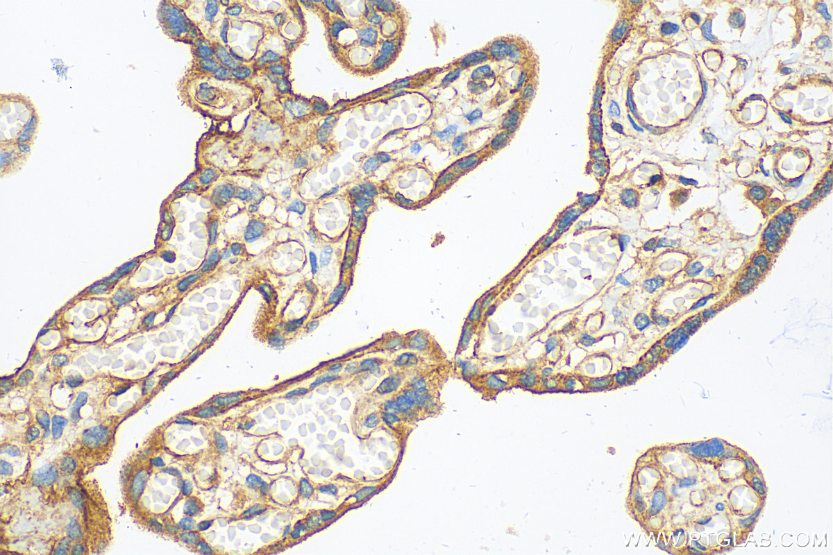 IHC staining of human placenta using 12594-1-AP