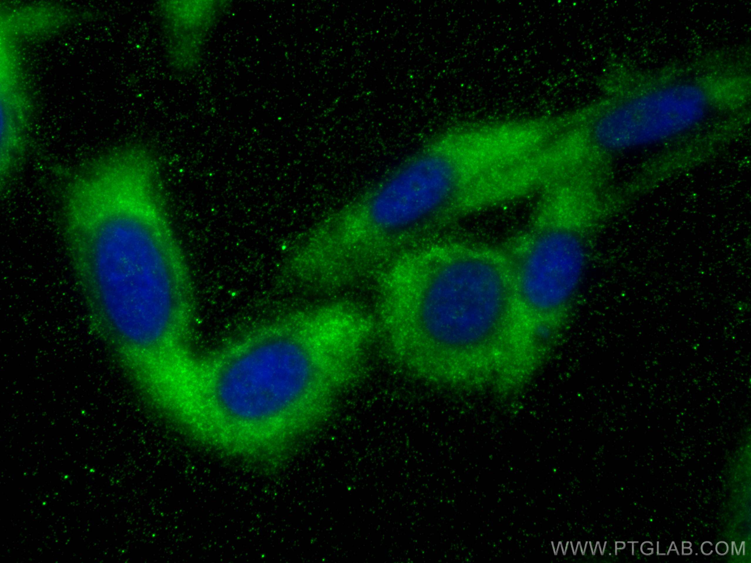 IF Staining of PC-3 using 12300-1-AP