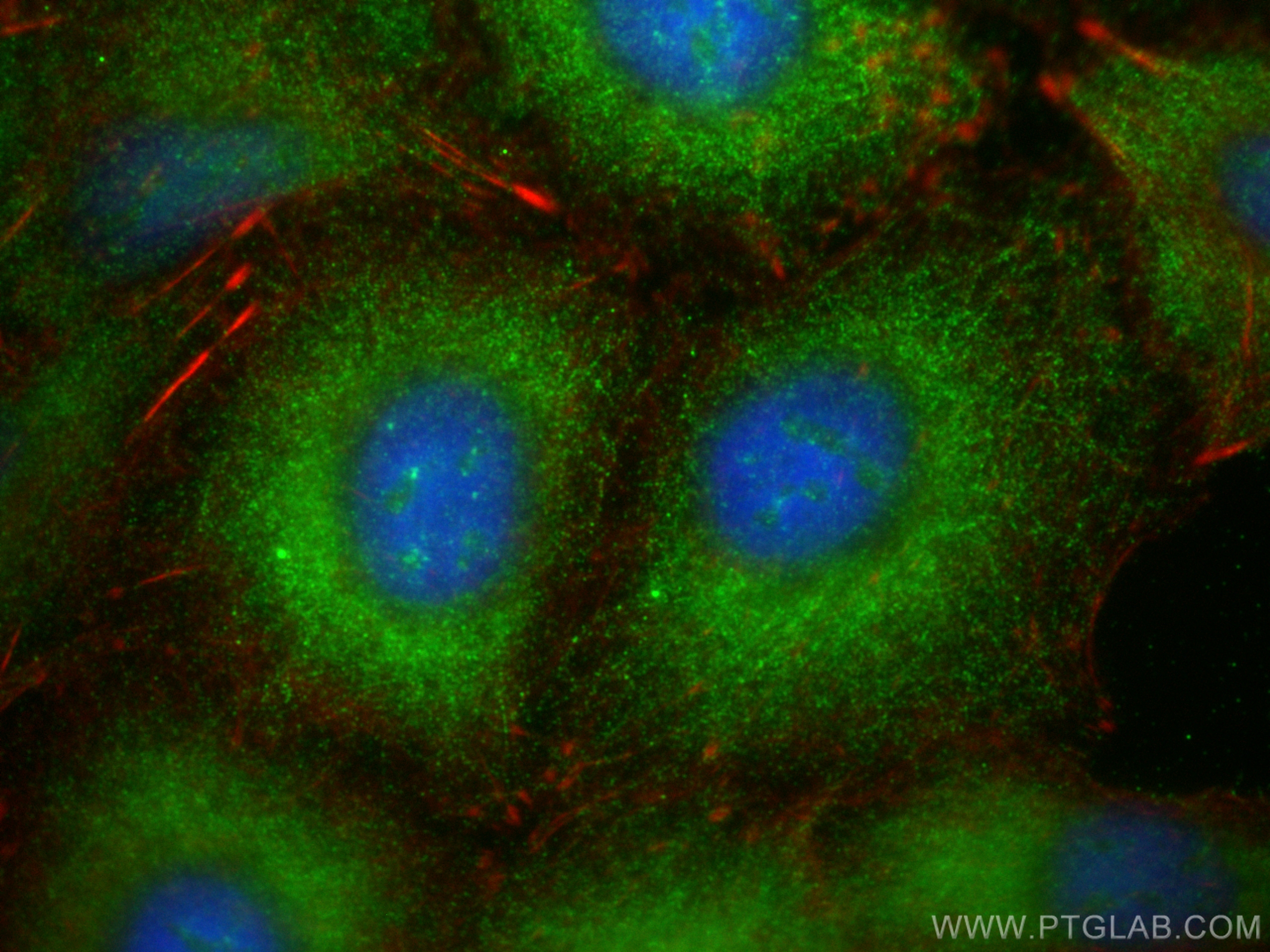 IF Staining of A549 using 10743-1-AP