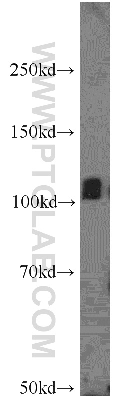 WB analysis of mouse brain using 12816-1-AP