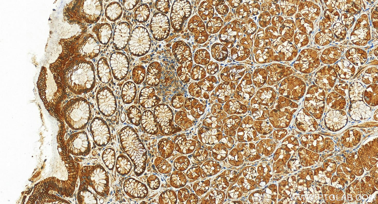 IHC staining of human stomach using 21862-1-AP