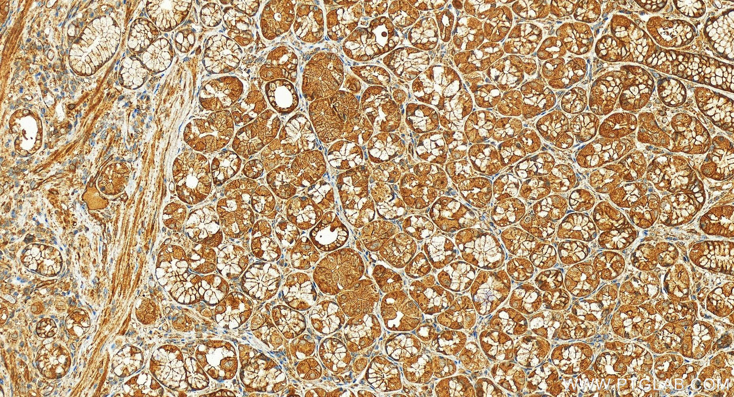 IHC staining of human stomach using 21862-1-AP