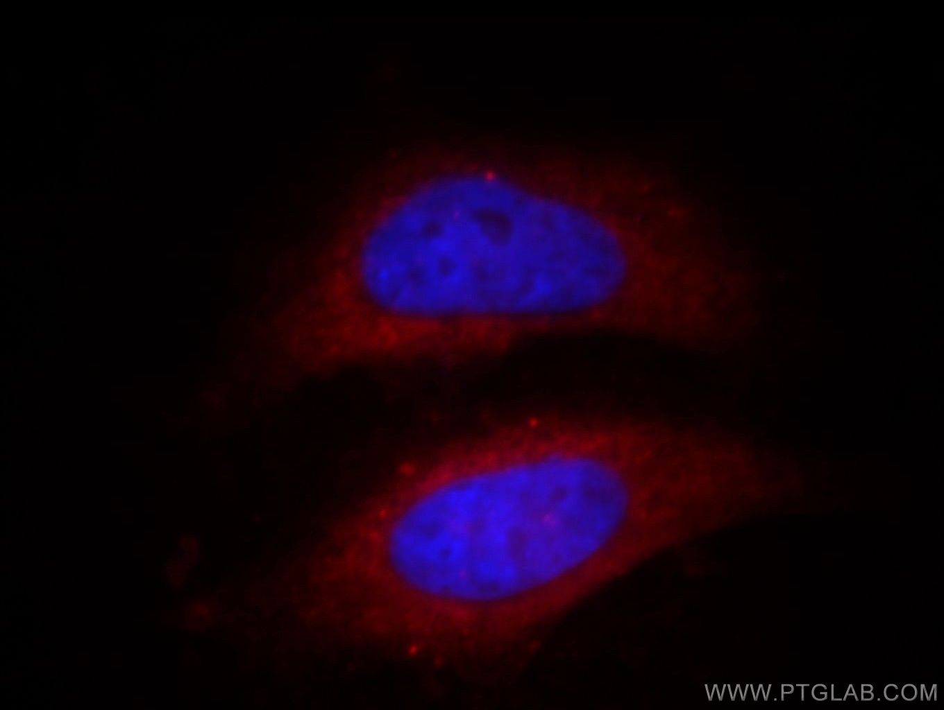 IF Staining of MCF-7 using 66032-1-Ig