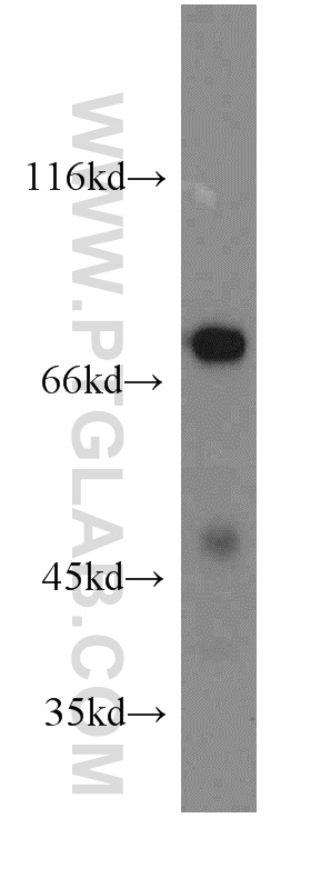 WB analysis of mouse heart using 14741-1-AP