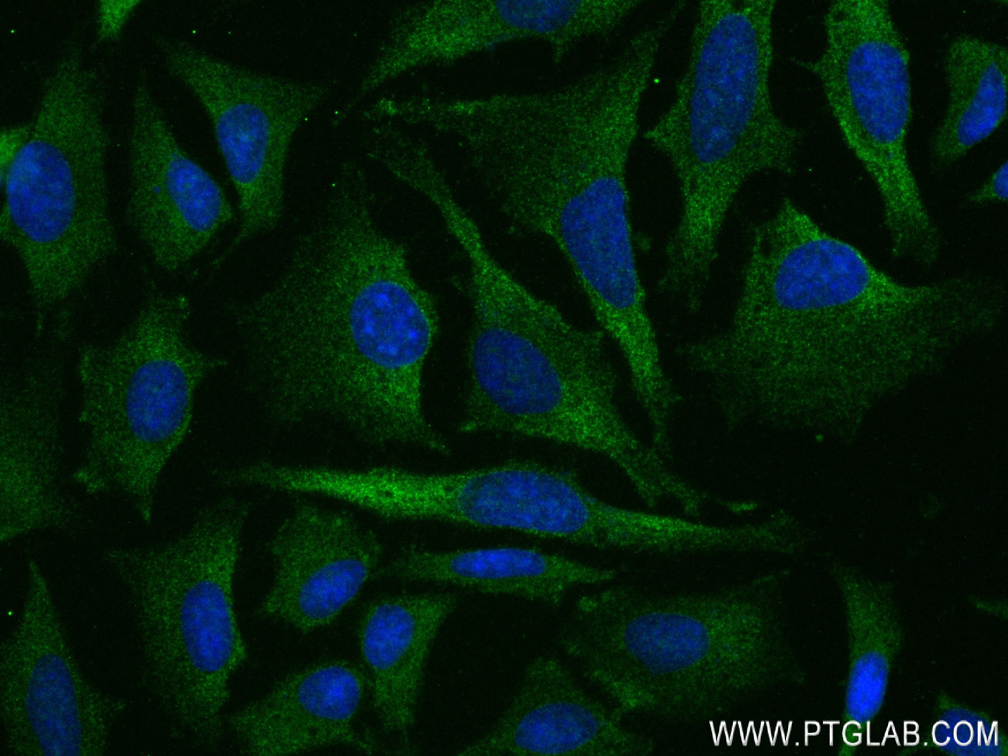 IF Staining of HeLa using 84268-1-RR (same clone as 84268-1-PBS)