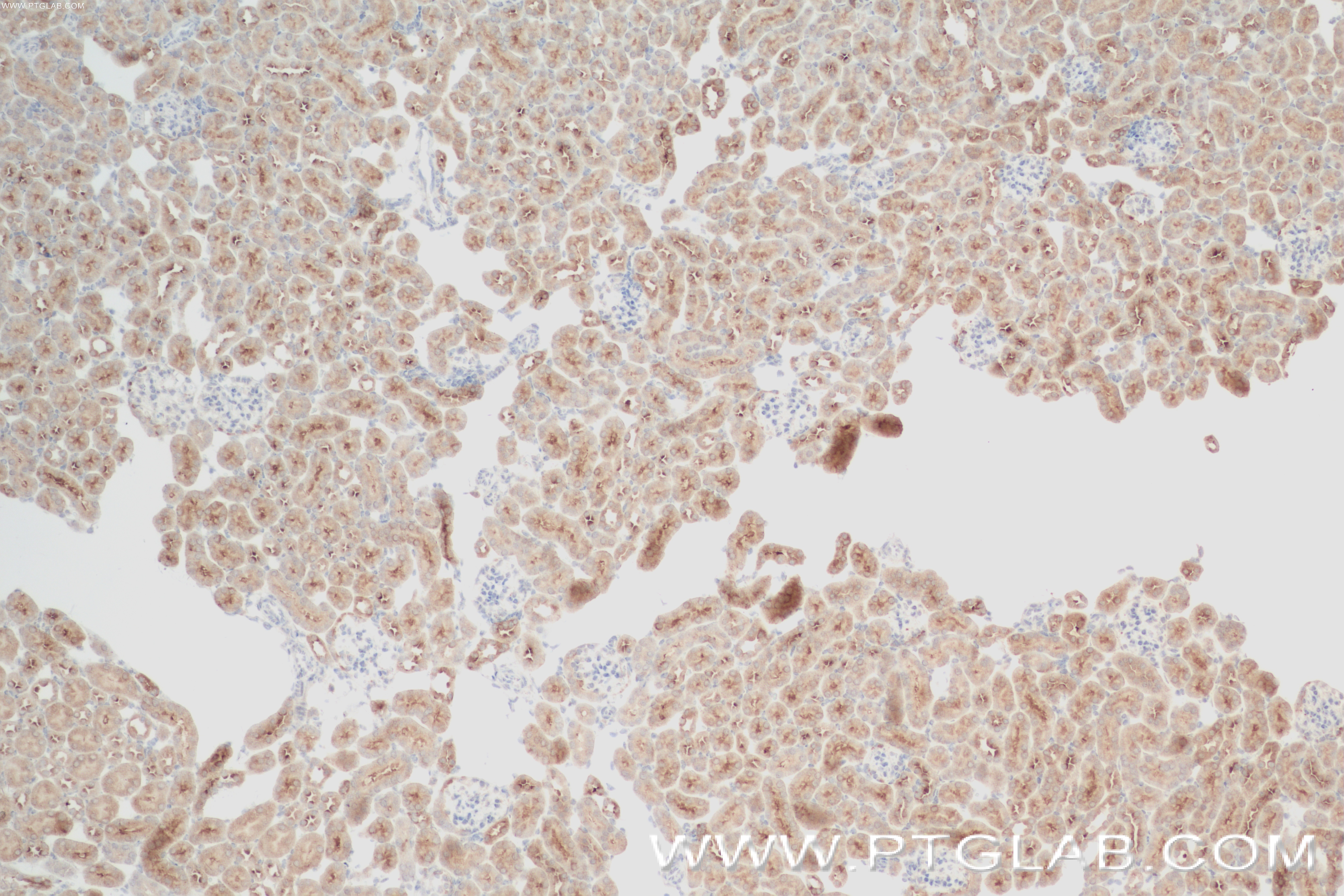 IHC staining of mouse kidney using 84268-1-RR (same clone as 84268-1-PBS)